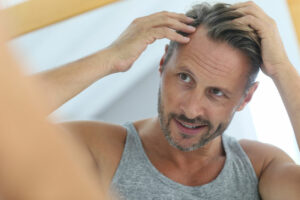 hair restoration hagerstown